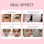 💆‍♀️ RF & EMS | Reafirma y Rejuvenece ✨💖